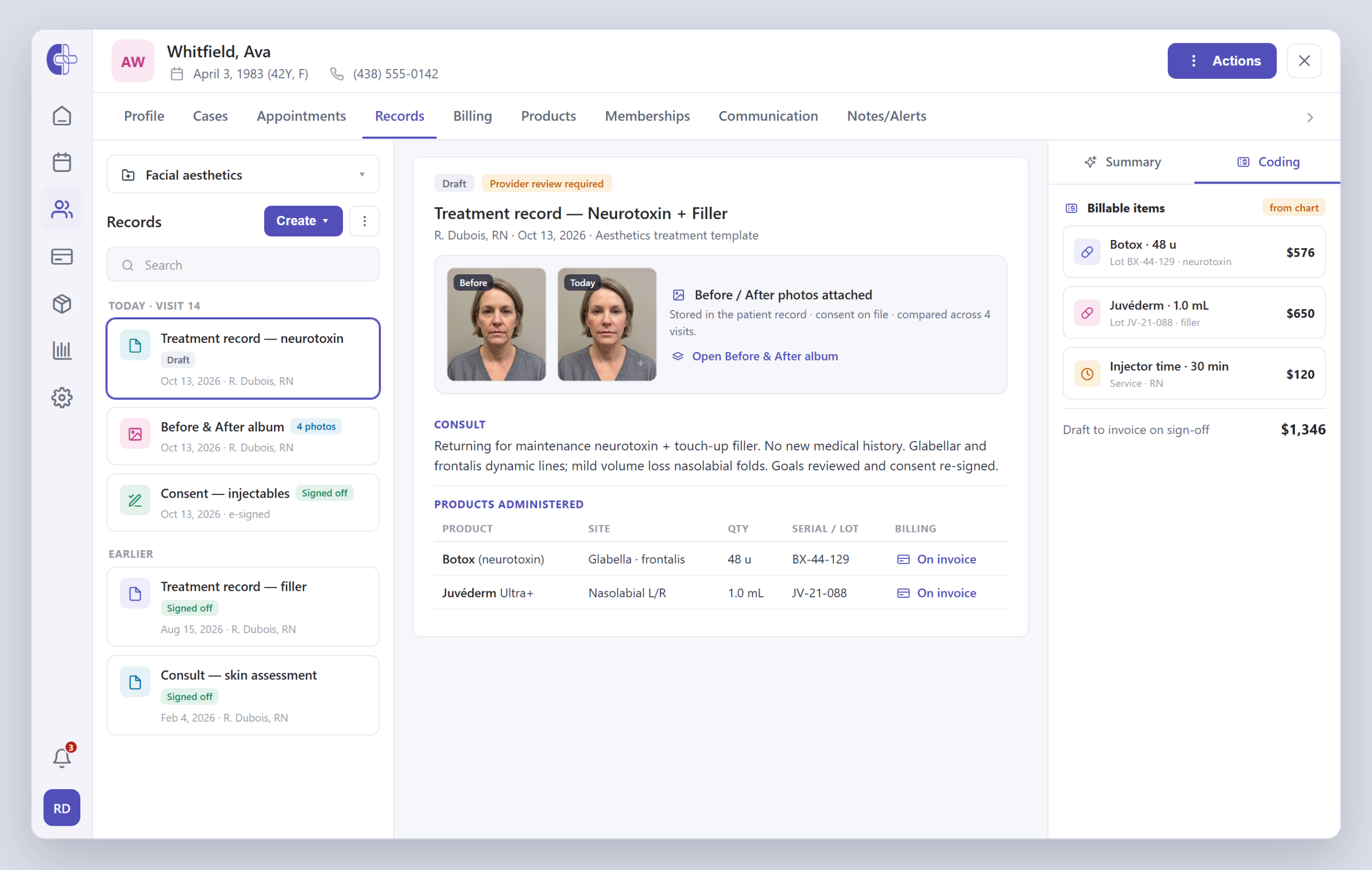 Clinicmaster before-and-after photo album inside a patient chart — two dated portraits shown side by side for comparison, an album list of prior visits, and an annotation toolbar.